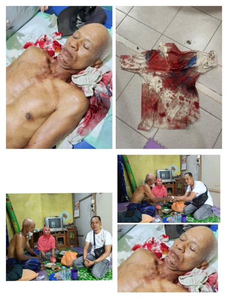 IWO Inhil & IWO Riau Buka Open Donasi untuk Tukang Becak Korban Pembacokan