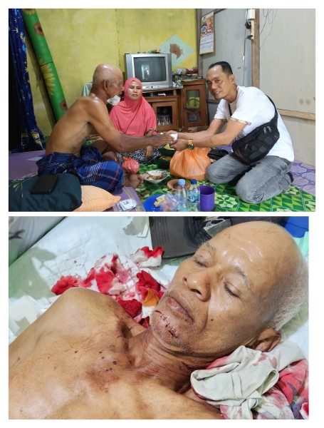 Usia 61 Tahun Masih Mengayuh Becak, Kini Suratman Tak Berdaya Usai Dibacok di Pasar